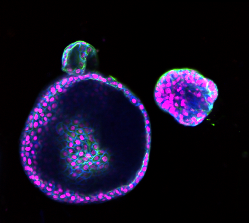 Human intestinal organoid fluorescent image