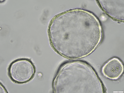 Human intestinal organoid brightfield image